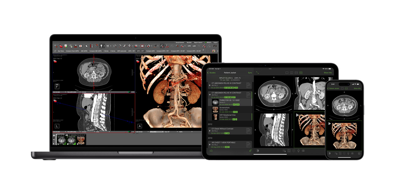Interface de l’app Visage, utilisée par les radiologues pour interpréter des fichiers de diagnostic volumineux.